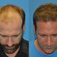 11a2b370ce2a10bb49a9dfdb90e6a5d3_-united