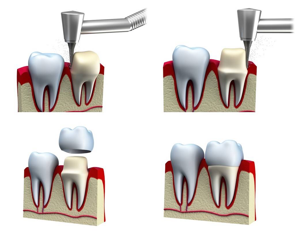 Naushil Desai D.M.D | 600 S Euclid St, Anaheim, CA 92802, USA | Phone: (714) 776-3535