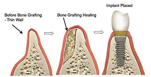 Dr. Faith L. Oliver, DDS | 420 E Pleasant Run Rd, DeSoto, TX 75115, USA | Phone: (214) 339-7500