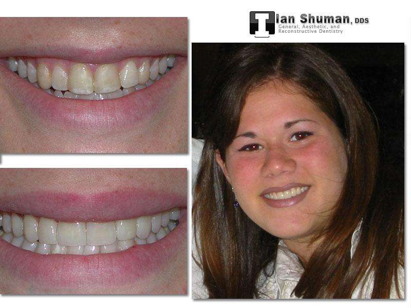 Dr. Ian Shuman, DDS | 8028 Ritchie Hwy Suite 306, Pasadena, MD 21122, USA | Phone: (410) 766-5104