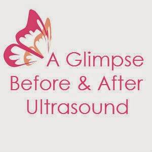 A Glimpse Before & After Ultrasound | 2276 N Broadway St, Moore, OK 73160 | Phone: (405) 735-8484