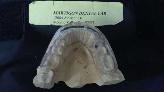 Martigon Dental Lab | 12684 Atherton Dr, Moreno Valley, CA 92555, USA | Phone: (951) 247-3459