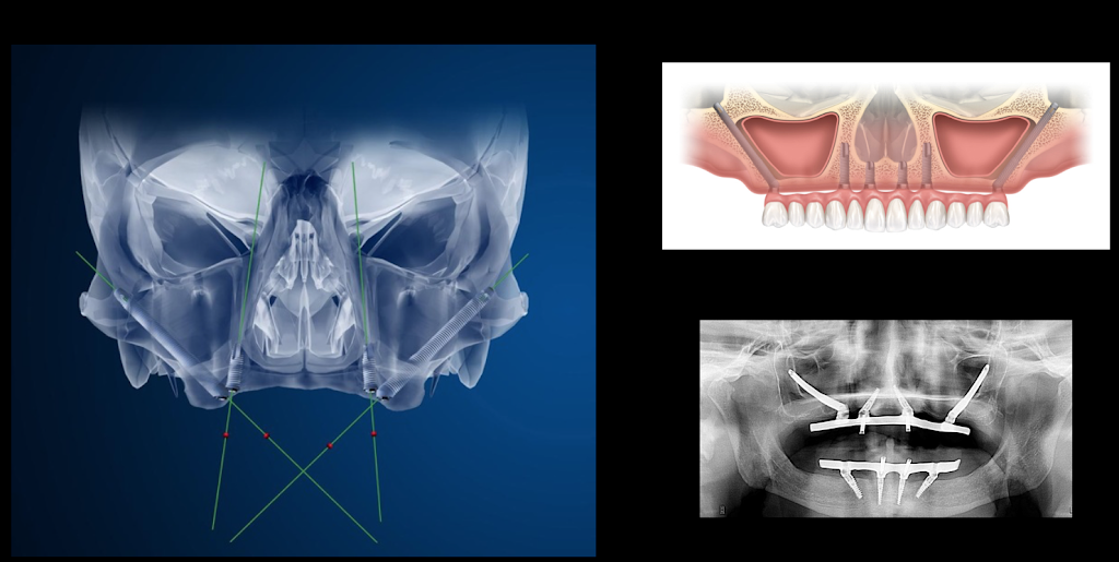 Alfonso Monarres DDS, MS, FACP. | 19375 Stone Oak Pkwy, San Antonio, TX 78258, USA | Phone: (210) 403-0555