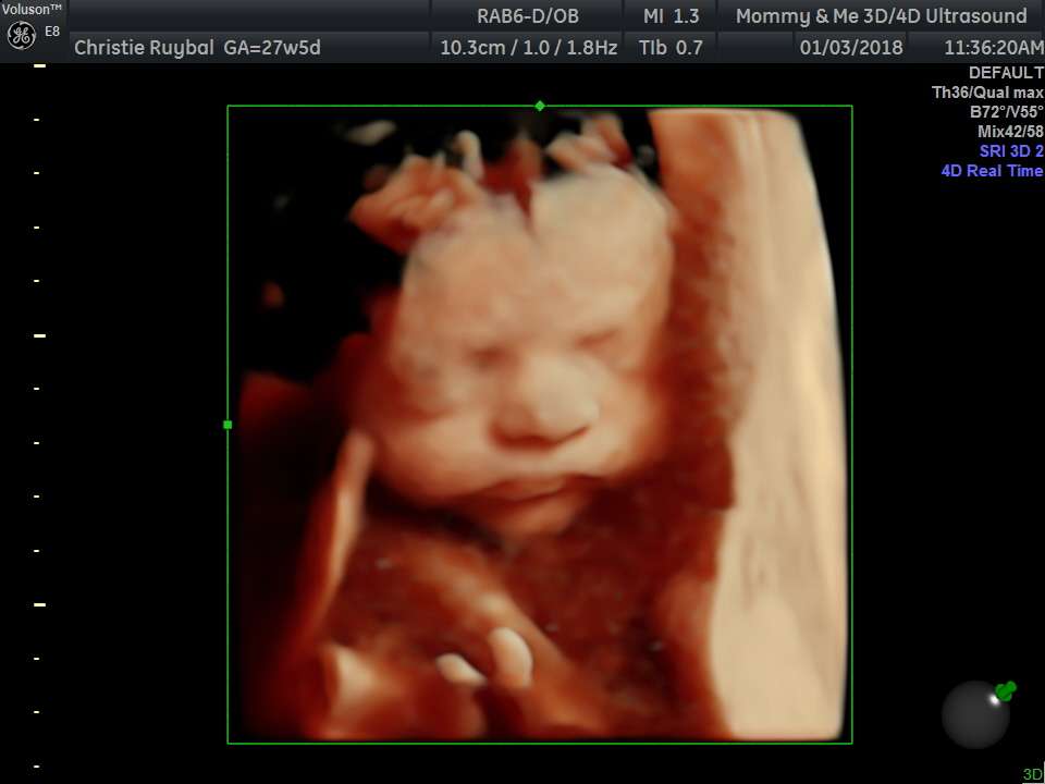 Mommy And Me 3d 4d HD Ultrasound - Westminister | 9100 W 100th Ave B1, Westminster, CO 80021, USA | Phone: (720) 584-1721