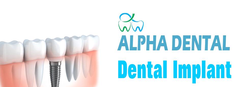 Alpha Dental Group 2 | 5870 SW 8th St Suite # 4, Miami, FL 33144, USA | Phone: (305) 392-1261