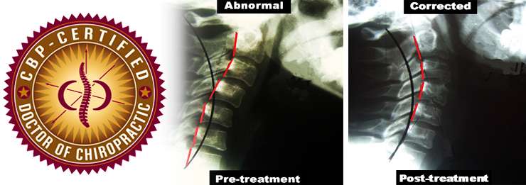 ADIOS Chiropractic, PC | 2500 Lemoine Ave #303, Fort Lee, NJ 07024, USA | Phone: (201) 363-0233