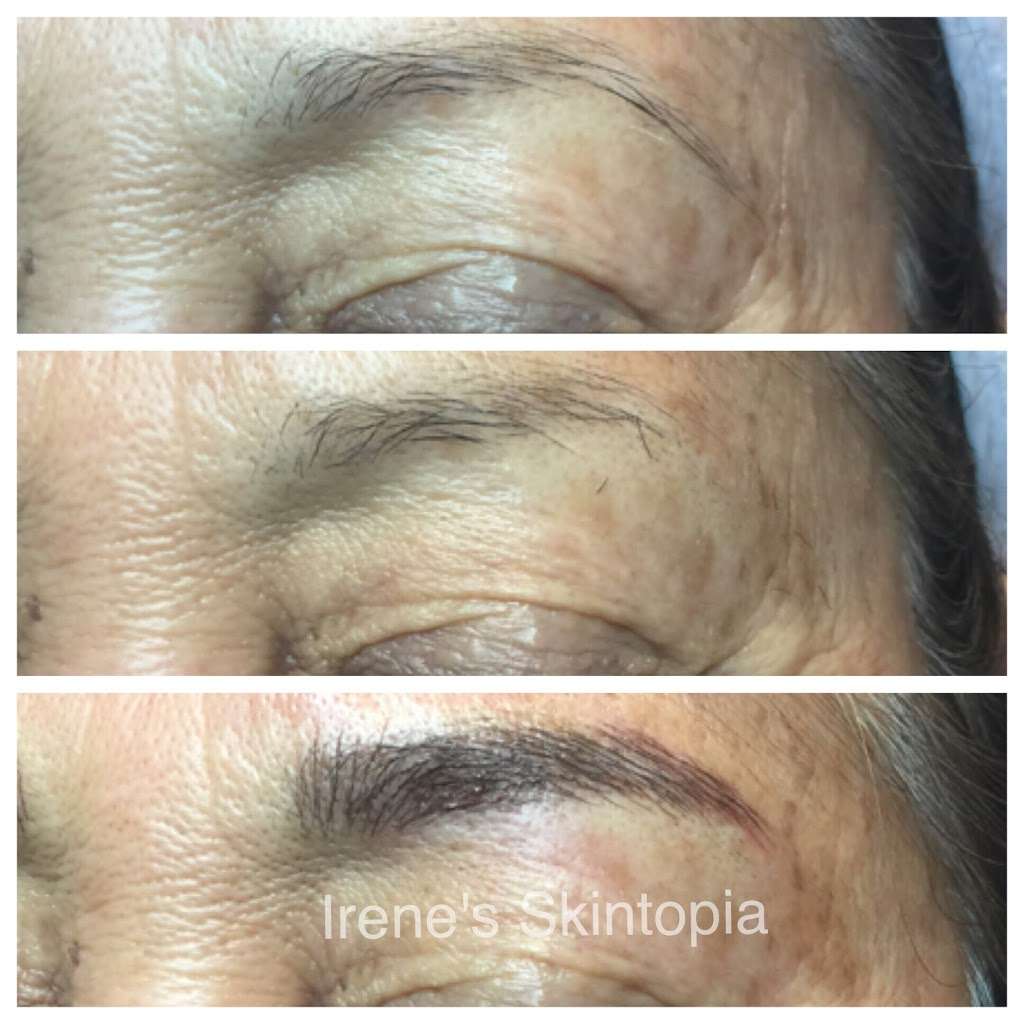 Irenes Skintopia | 3130 W Olympic Blvd #270, Los Angeles, CA 90006, USA | Phone: (213) 703-7037