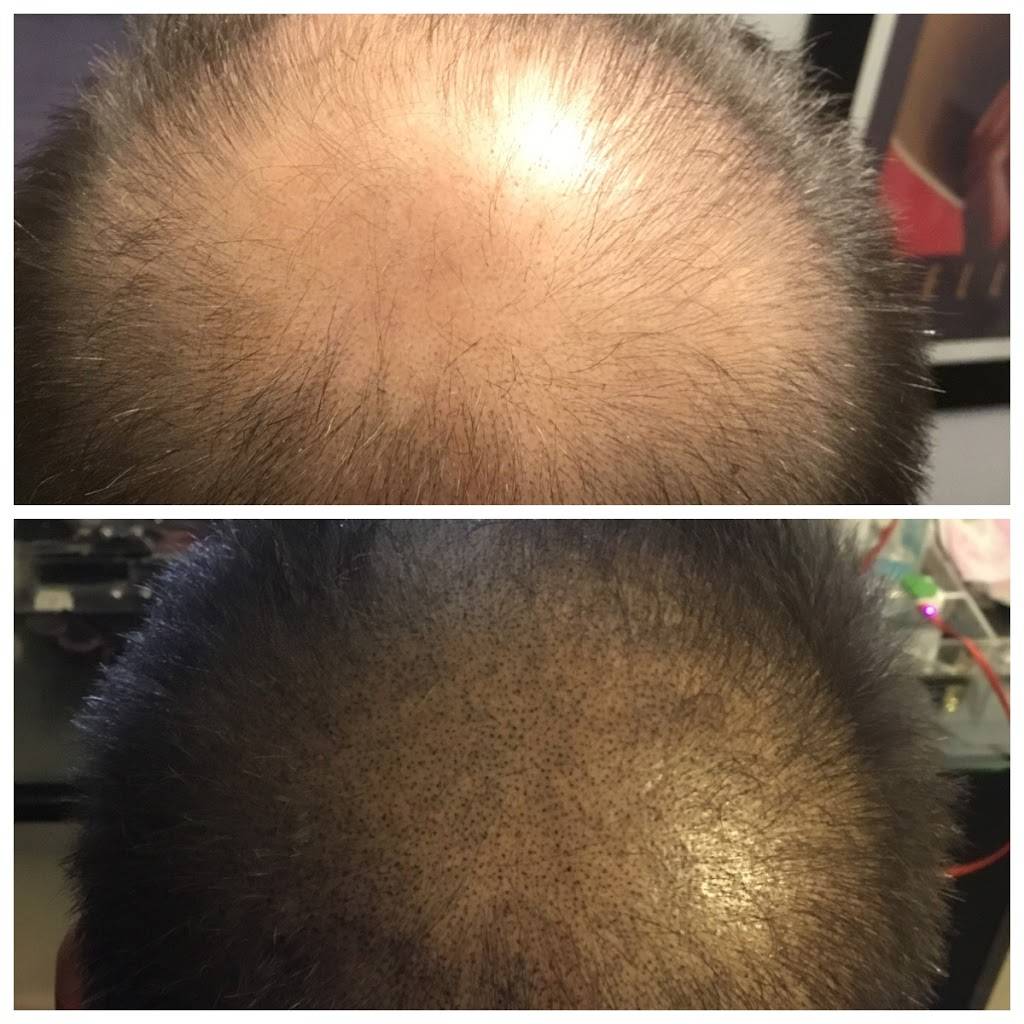 Scottsdale Hairlines Scalp MicroPigmentation Hairloss Clinic | 3295 N Drinkwater Blvd Suite 16, Scottsdale, AZ 85251, USA | Phone: (602) 680-0008