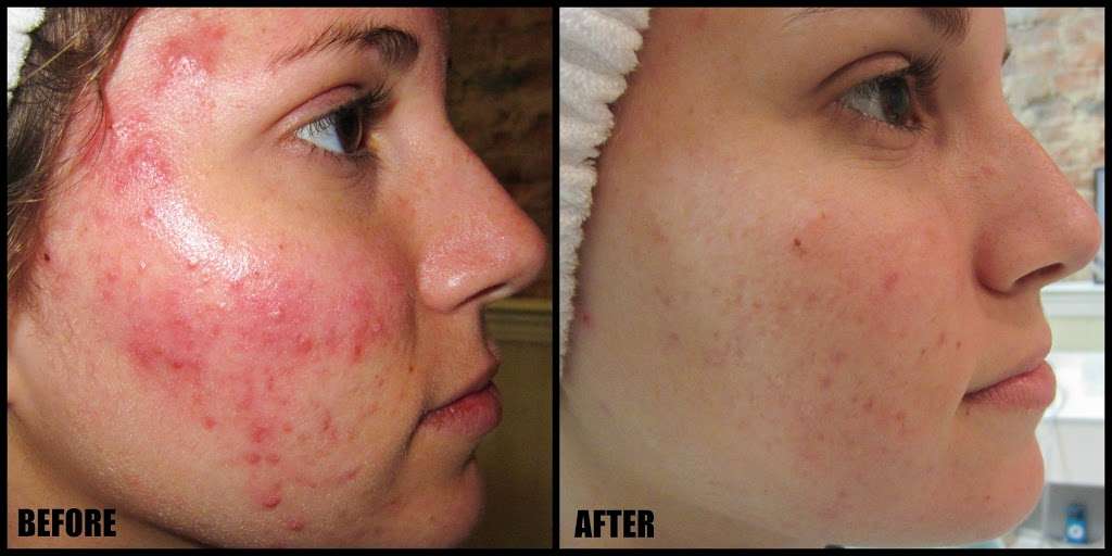 Fresh Faced Skin Care | 204 Delaware St, New Castle, DE 19720, USA | Phone: (302) 689-3223