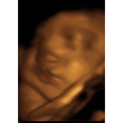 Prenatal Life Imagining 3D/4D Ultrasound | 2424 N Grand Ave Suite A, Santa Ana, CA 92705, USA | Phone: (714) 881-1213