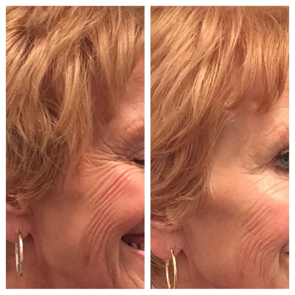Dr. Happe Medical Aesthetics, LLC | 15 Homestead St, Waban, MA 02468, USA | Phone: (617) 597-2600 Dr. Happe Medical Aesthetics, LLC | 15 Homestead St, Waban, MA 02468, USA | Phone: (617) 597-2600