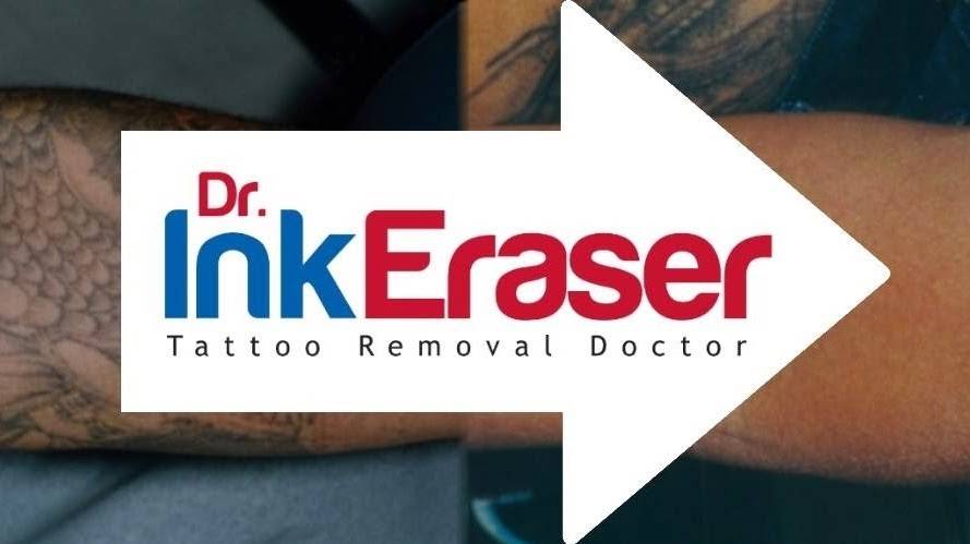 Dr. Ink Eraser Tattoo Removal Birmingham, AL | 944 18th St S suite c, Birmingham, AL 35205, USA | Phone: (205) 530-9630