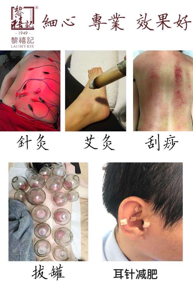 黎禧记中医针灸拔罐艾灸刮痧中药 Acupuncture cupping | 159 E LIVE OAK AVE, STE 107, ARCADIA, CA 91006, USA | Phone: (626) 205-8330