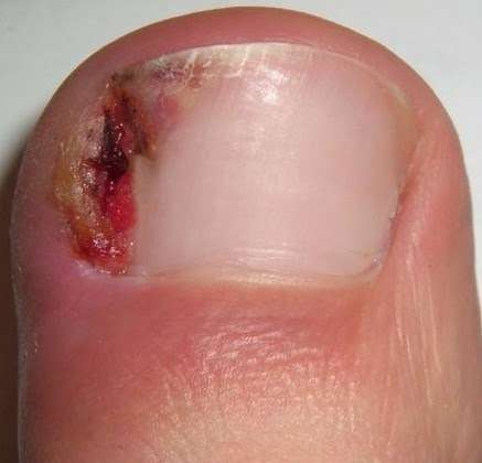 University Foot and Ankle Specialists, Inc., - Richard Tu, DPM | 230 Prospect Pl #210, Coronado, CA 92118, USA | Phone: (619) 269-4747