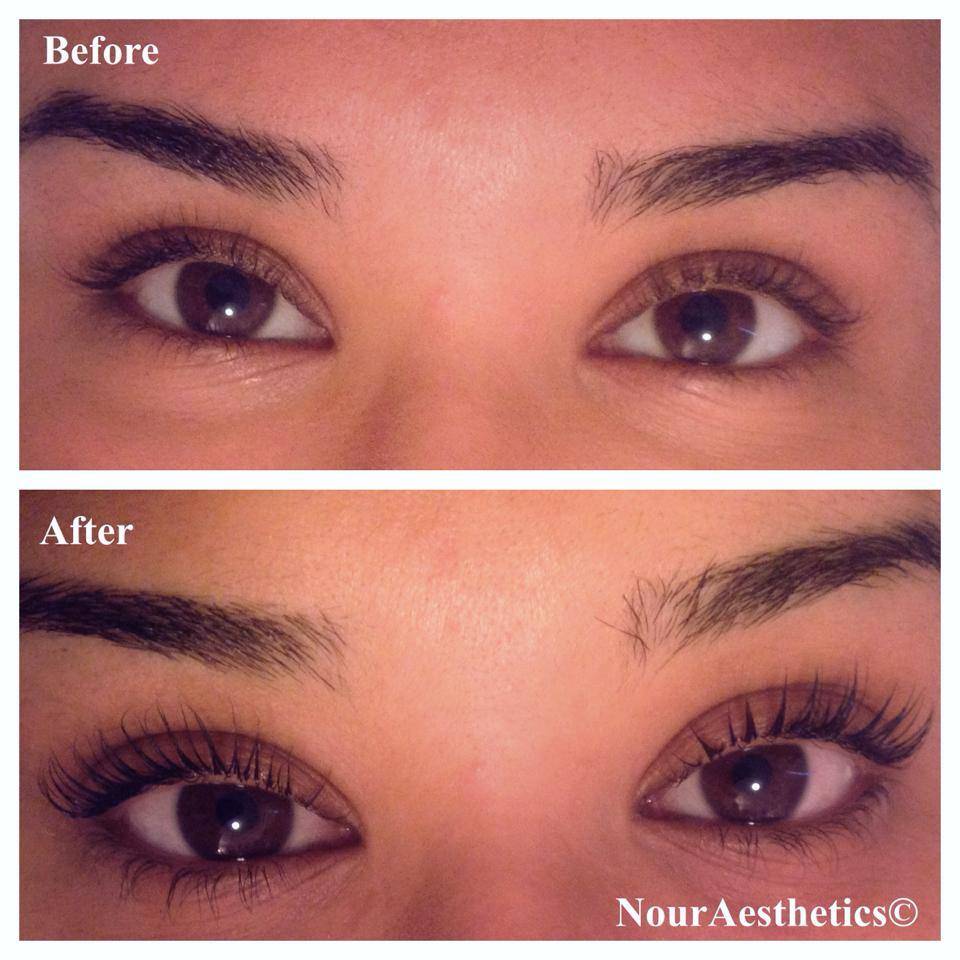 nouraesthetics | 1601 Abbott Rd #202, Anchorage, AK 99507, USA | Phone: (907) 717-7047