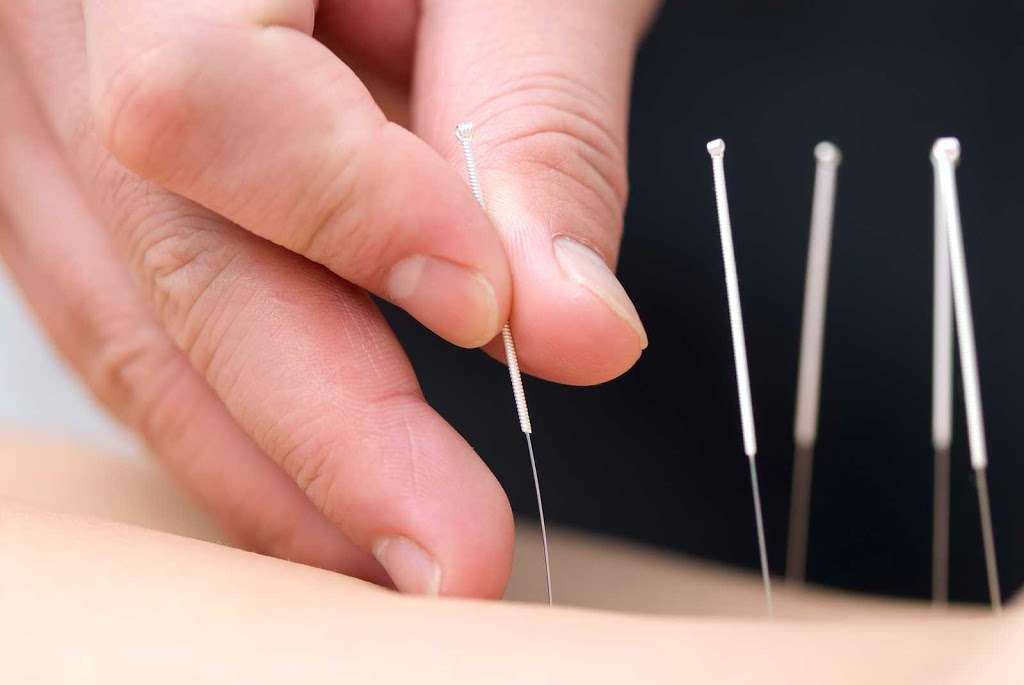 Shenphen Ling Healing Center | 61 Renato Ct #15, Redwood City, CA 94061, USA | Phone: (408) 898-4308