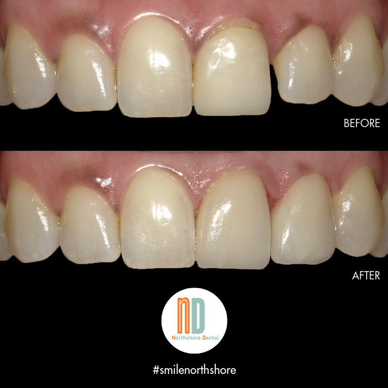 Northshore Dental | 2 Evanston St, Houston, TX 77015, USA | Phone: (713) 453-7466