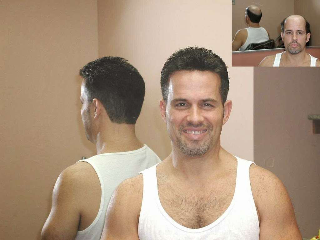 Manny Roberts Hair Replacement | 4 Expy Plaza Ll14, Roslyn Heights, NY 11577, USA | Phone: (800) 456-4247