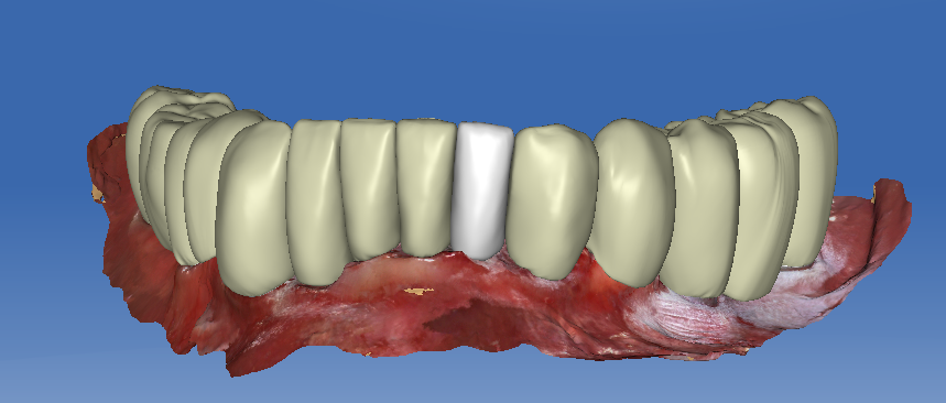 Digital Dental Designs | 3651 E Tremont Ave, Bronx, NY 10465, USA | Phone: (914) 584-9753