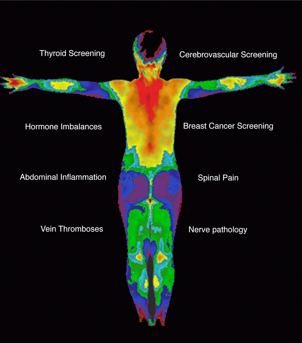 Breast and Body Thermography | 2358 Sunshine Rd, Allentown, PA 18103 | Phone: (484) 225-8760