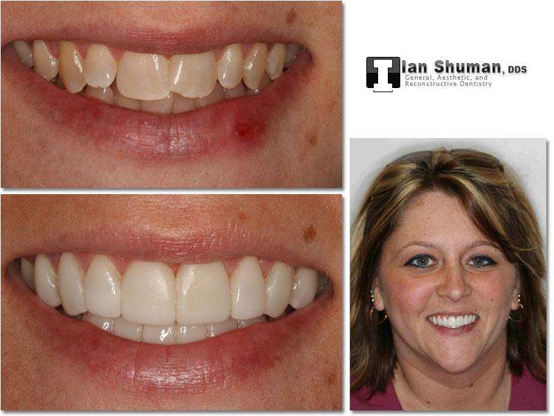 Dr. Ian Shuman, DDS | 8028 Ritchie Hwy Suite 306, Pasadena, MD 21122, USA | Phone: (410) 766-5104