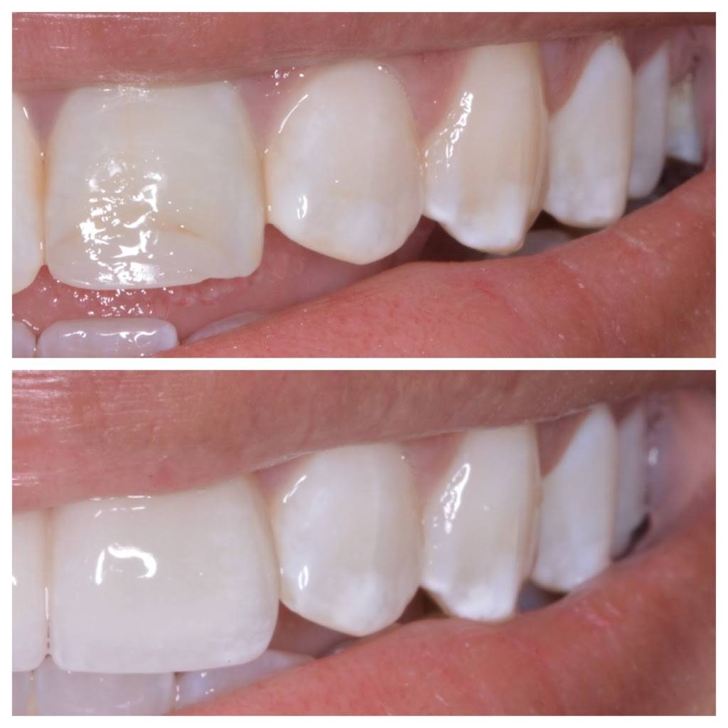 Zenith Dental Care Dearborn Family and Cosmetic Dentist, Mahmoud Farhat DDS | 18590 W Outer Dr, Dearborn, MI 48128, USA | Phone: (313) 406-9612