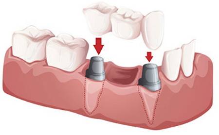 Spearmint Dental & Orthodontics - Princeton | 670 W Princeton Dr #600, Princeton, TX 75407, USA | Phone: (469) 270-5041