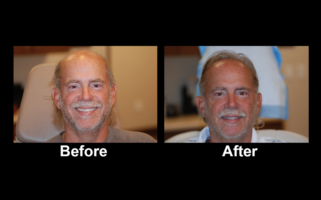 Halby Hair Transplant, Ltd. | 5524 S Fort Apache Rd Suite #100, Las Vegas, NV 89148, USA | Phone: (702) 258-6229