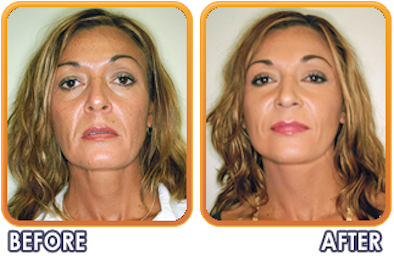 Palm Beach Plastic And Cosmetic Surgery | 400 Ave of the Champions, Palm Beach Gardens, FL 33418, USA | Phone: (561) 200-3385