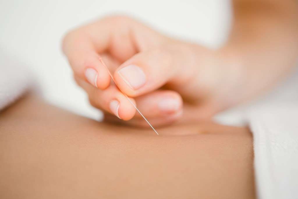 Kd Acupuncture Therapy | 9606 Tierra Grande St Suite 203, San Diego, CA 92131, USA | Phone: (858) 376-3650