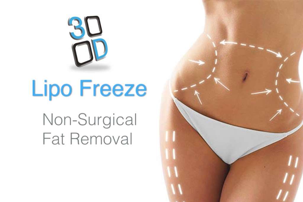 3D Body Contouring Ltd | Sandown Park, Tunbridge Wells TN2 4RP, UK | Phone: 01892 570212