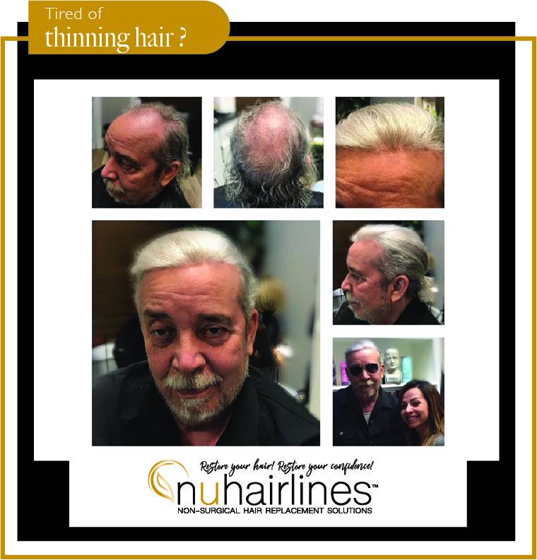 NUHAIRLINES - Non Surgical Hair Replacement Solutions | 9689 N. Hayden Rd. Ste. 100 In the Salon Boutique Building Suite #10, Scottsdale, AZ 85258, USA | Phone: (480) 850-3120