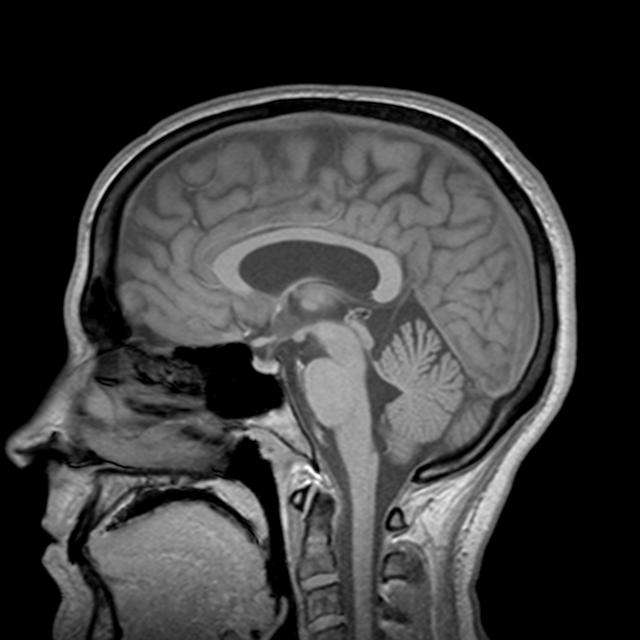 InSight Medical Imaging 2009 Warrenville Rd Lisle IL 60532 USA