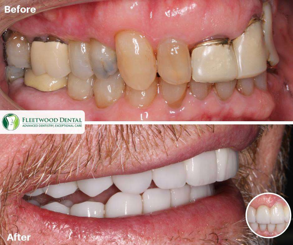 Fleetwood Dental | 805 N Richmond St suite 102, Fleetwood, PA 19522 | Phone: (610) 944-9771