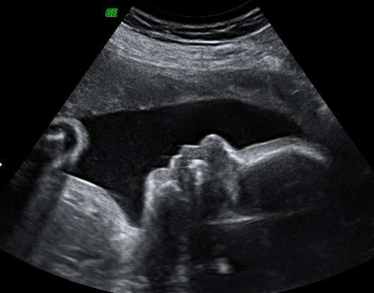 Love View 3D/4D Ultrasound Studio, LLC | 32222 Tamina Rd Suite A5, Magnolia, TX 77354, USA | Phone: (936) 524-9737