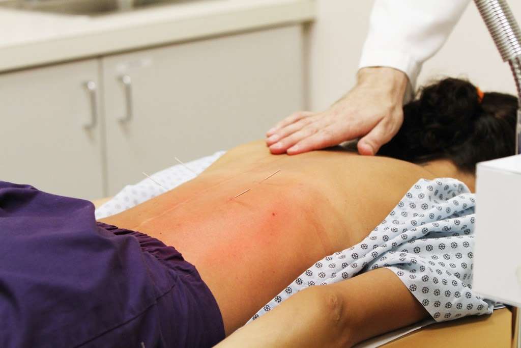 Little Acupuncture | 1601 Town Center Blvd, Weston, FL 33326, USA | Phone: (954) 349-6551 Little Acupuncture | 1601 Town Center Blvd, Weston, FL 33326, USA | Phone: (954) 349-6551