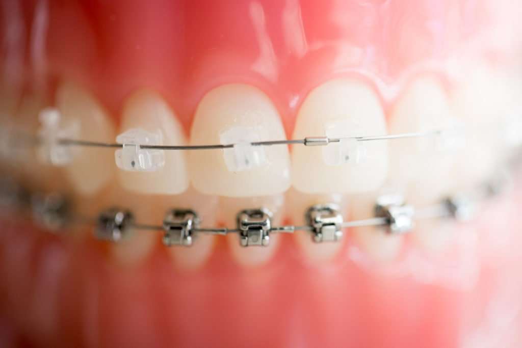 Orange County Orthodontics | 33 NY-17M, Harriman, NY 10926 | Phone: (845) 774-2724