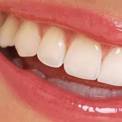 Smiles By Alex | 8884 Warner Ave, Fountain Valley, CA 92708, USA | Phone: (714) 962-2788