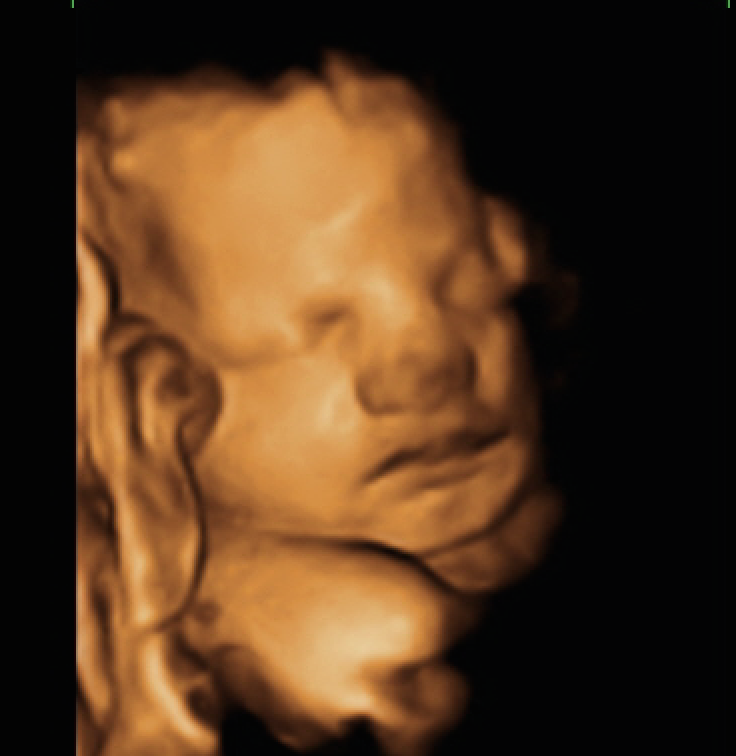 My Sweet Baby 3D/4D Ultrasounds | 5530 25th St, Columbus, IN 47203, USA | Phone: (812) 260-1881