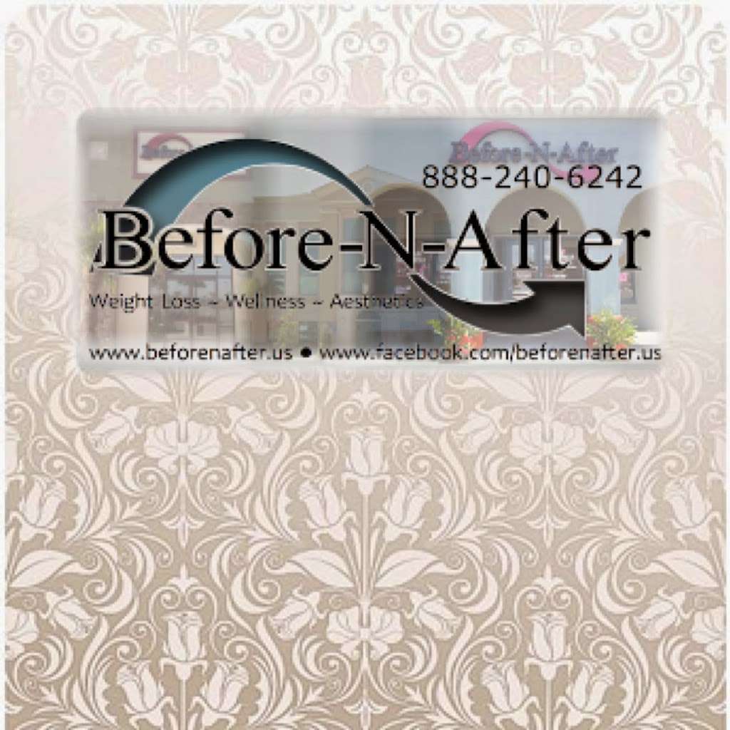 Before-N-After Weight Loss, Wellness and Aesthetics | 27701 Scott Rd #101, Menifee, CA 92584, USA | Phone: (888) 240-6242