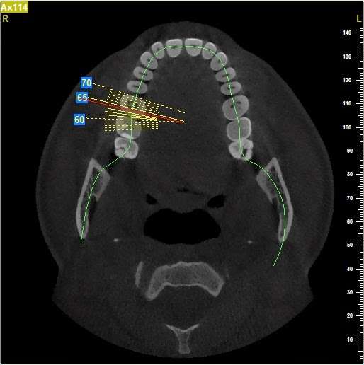 VGimaging | 1000 E Ogden Ave, Naperville, IL 60563, USA | Phone: (331) 444-9955