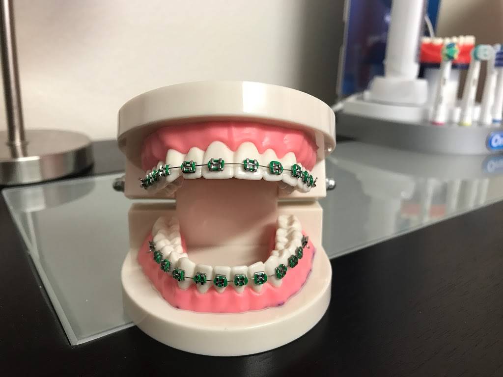 North Las Vegas Orthodontics | 2365 Reynolds Ave #101, North Las Vegas, NV 89030, USA | Phone: (702) 476-2444