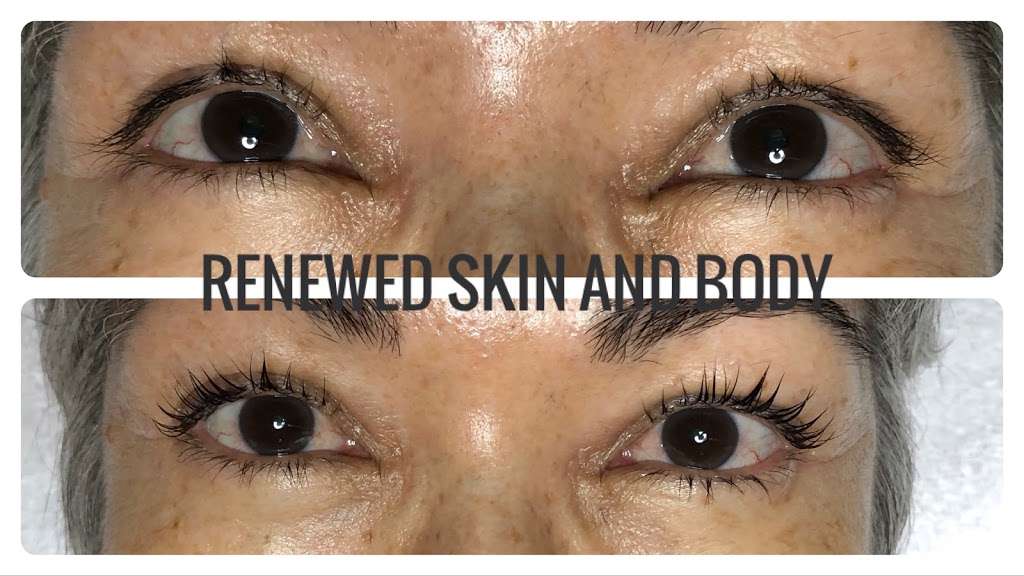 Renewed Skin & Body | 5930 W Greenway Rd Ste 18C, Glendale, AZ 85306, USA | Phone: (623) 469-5770