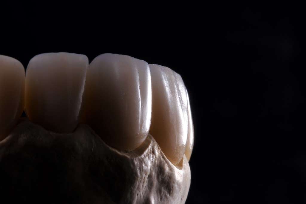 Progressive Dental Ceramics | 2100 Carlmont Dr #2, Belmont, CA 94002 | Phone: (650) 592-1938