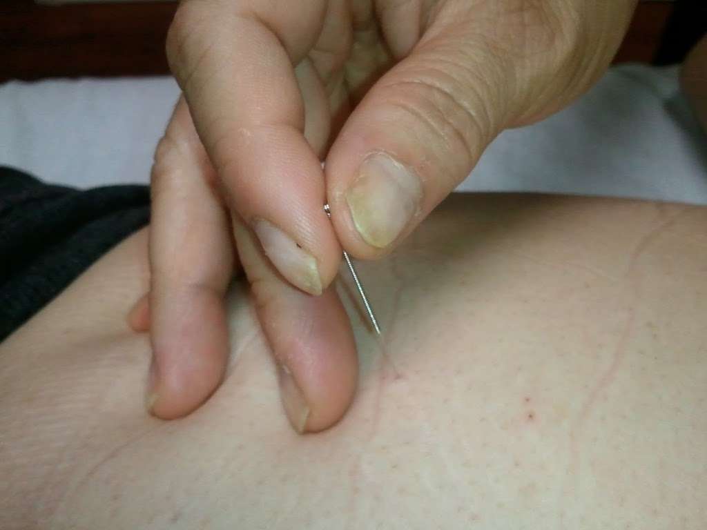 Sherry Acupuncture | 26781 Portola Pkwy #4b, Foothill Ranch, CA 92610 | Phone: (949) 583-2881