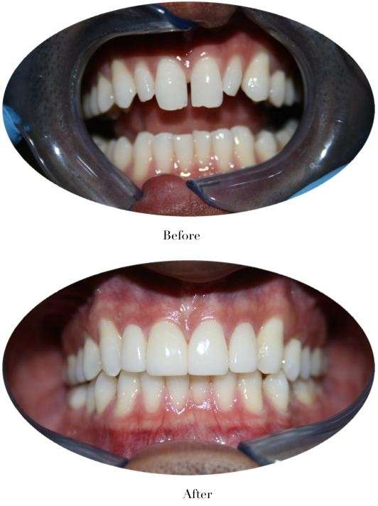 Brite Smile Dental | 6280 Jackson Dr Ste 2, San Diego, CA 92119, USA | Phone: (619) 667-3330