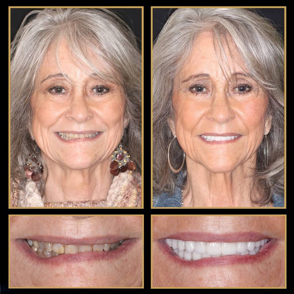 The Cosmetic Dentists of Austin | 2700 Barton Creek Blvd #130, Austin, TX 78735, USA | Phone: (512) 333-7777