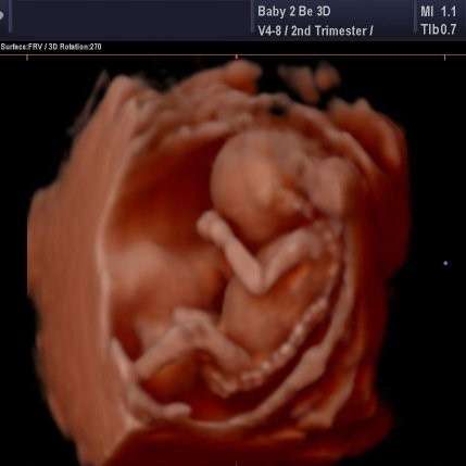 Baby To Be 3D | 913 W Main St, Plymouth, PA 18651, USA | Phone: (570) 550-5299