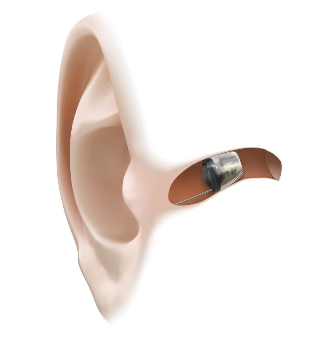 A1 Hearing Aid Centers Voted Best | 1132 San Marino Dr #206, San Marcos, CA 92078 | Phone: (760) 632-8000