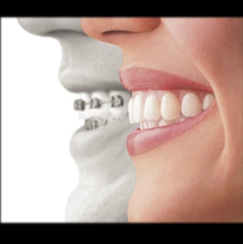 RS Orthodontics | 46 Trifecta Pl, Charles Town, WV 25414, USA | Phone: (304) 725-0126